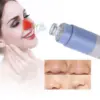 Ηλεκτρική σκούπα μαύρων στιγμάτων – Pore device » Murzl Ηλεκτρική σκούπα μαύρων στιγμάτων – Pore device - Image 5