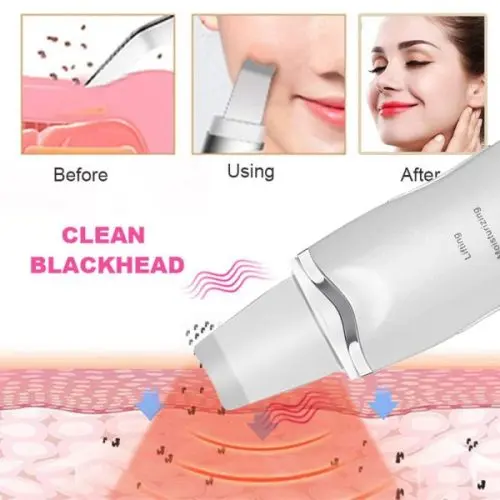 Σπάτουλα προσώπου υπερήχων - LMC Beauty Ultrasonic » Murzl Ha84ed036acb14a57bba488112110480dR-1-500x500
